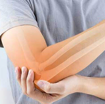 NIOS Structural Repair